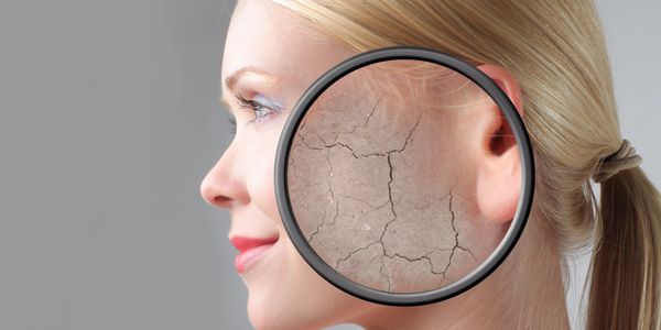 Laser facial, genesis, skin rejuvenation