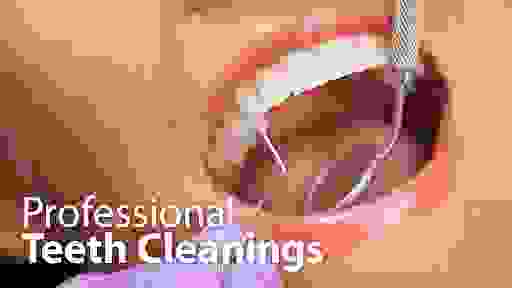 professional teeth cleaning 