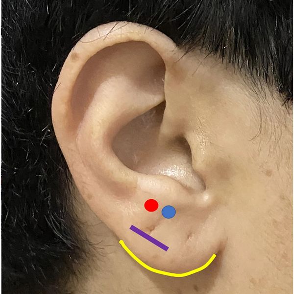 Close-up of an ear with colored markings.