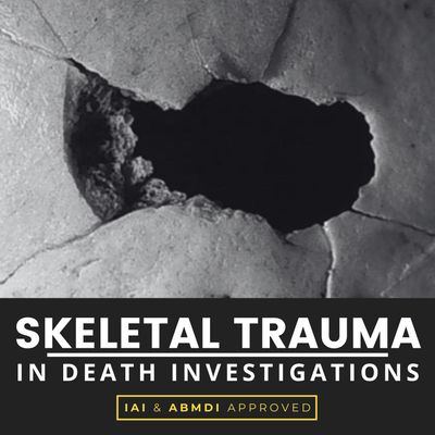 Close-up of a cracked skull with skeletal trauma in a forensic context.