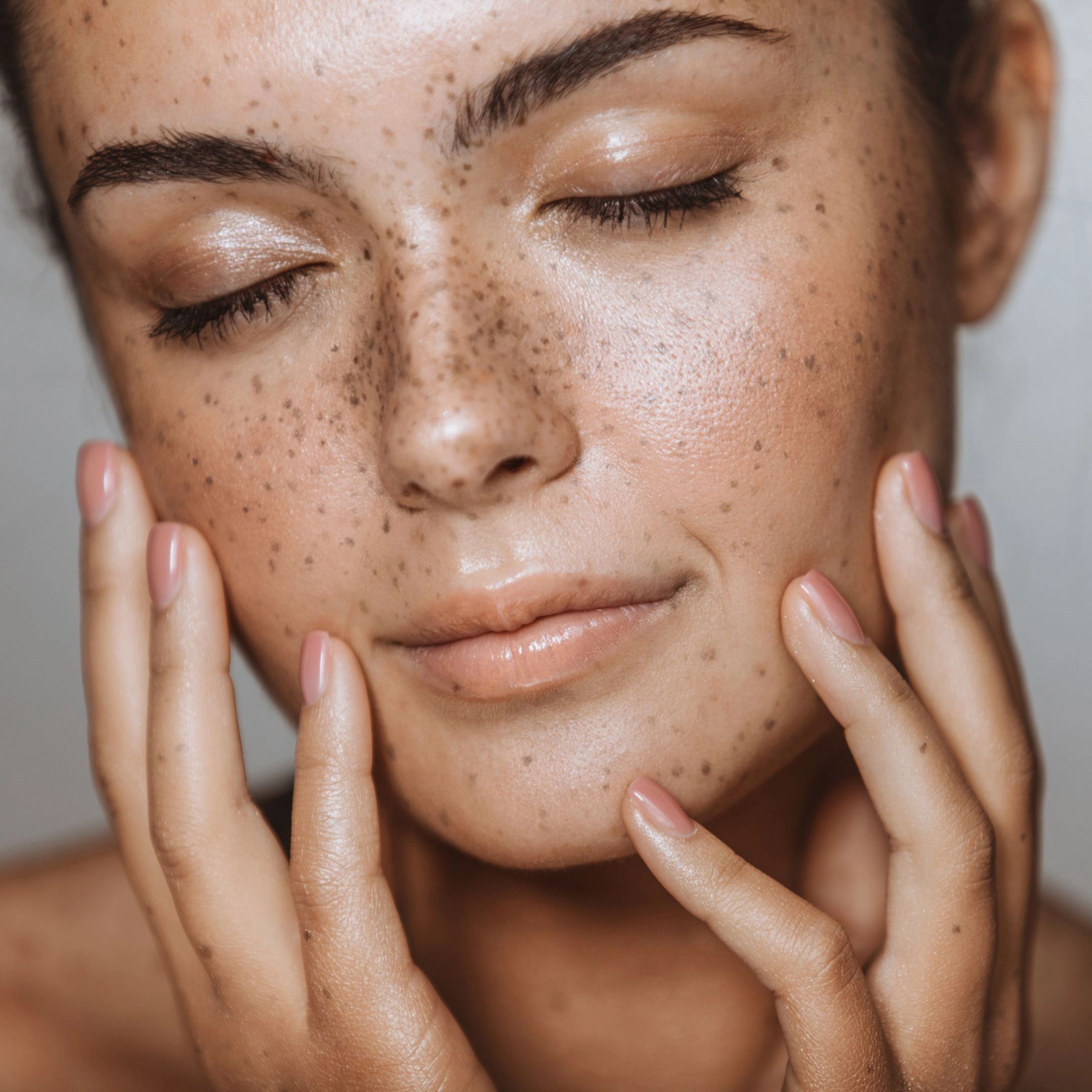 A client receiving a chemical peel at NATIV Aesthetics  in Centennial, CO, for skin rejuvenation
