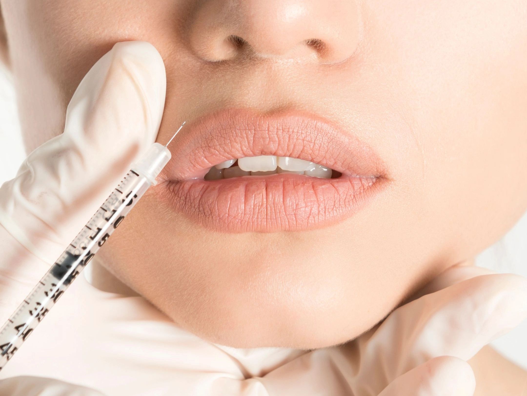 Client receiving dermal filler injections at NATIV Aesthetics in Centennial CO, for added volume