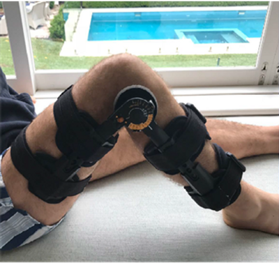 Cross Bracing Protocol