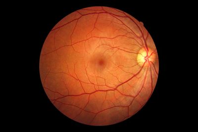 Detailed image of the human retina showing blood vessels and optic disc.