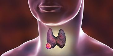 thyroid disease hashimotoes hypothyroid hyperthyroid 