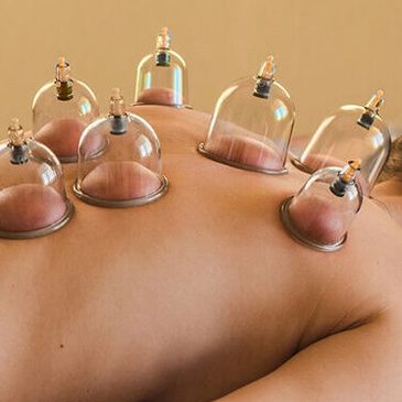 Cupping, myofascial decompression, sports recovery, cuptherapy