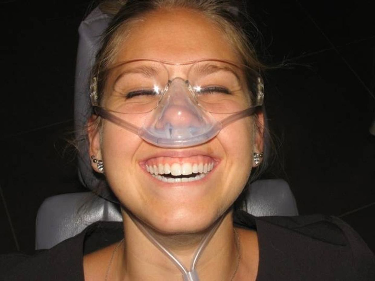 Silhouette Mask, Low Profile Mask for Nitrous Oxide Sedation administration. For Nitrous Oxide Sedation