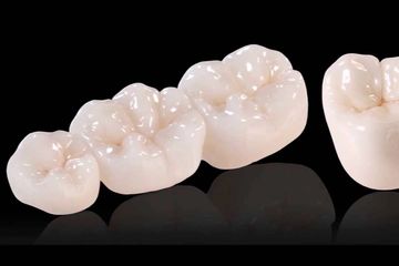 Dental Crown Bridge | West Hartford | New Britain | Best | Dentist | Whitening