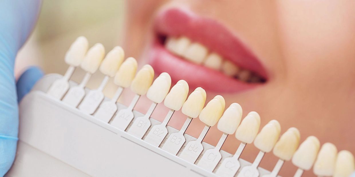 Cosmetic Dentistry | West Hartford | New Britain | Best | Dentist | Whitening | Crown | Veneers