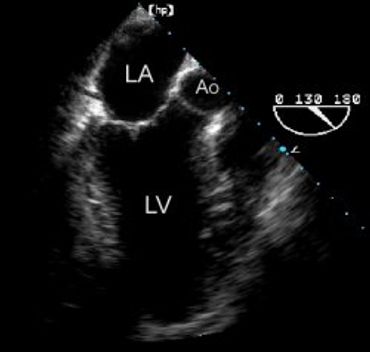 contamos con equipos de ecocardiografía de alta resolución