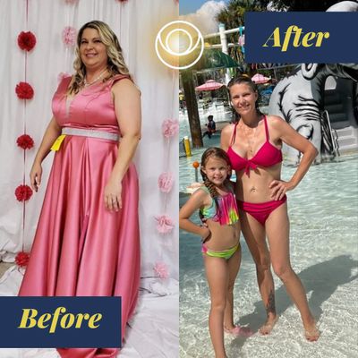 weightloss before and after