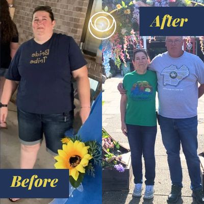 weightloss before and after