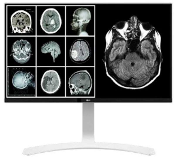 Monitor grado médico para visualizar estudios de tomografía