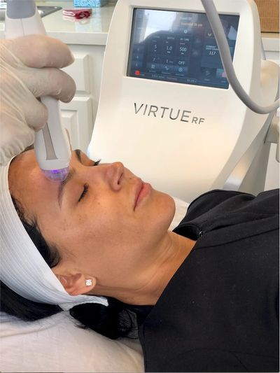 Vampire Facial Vero Beach PRP Facial Vero Beach VirtueRF Microneedling Vero Beach