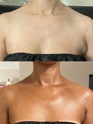 Before and after images showing a dramatic skin tanning transformation on a woman's upper chest and shoulders.