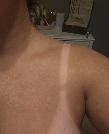 A person's shoulder with a clear tan line showing skin contrast.