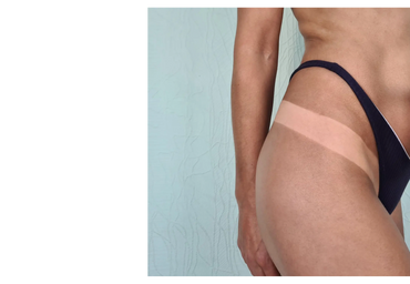 Close-up of a woman's hip showing distinct tan lines from a bikini.