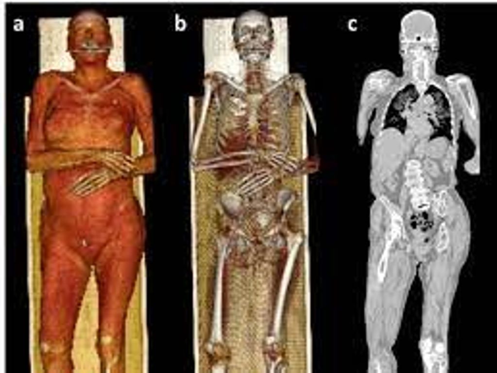 Virtual  autopsy