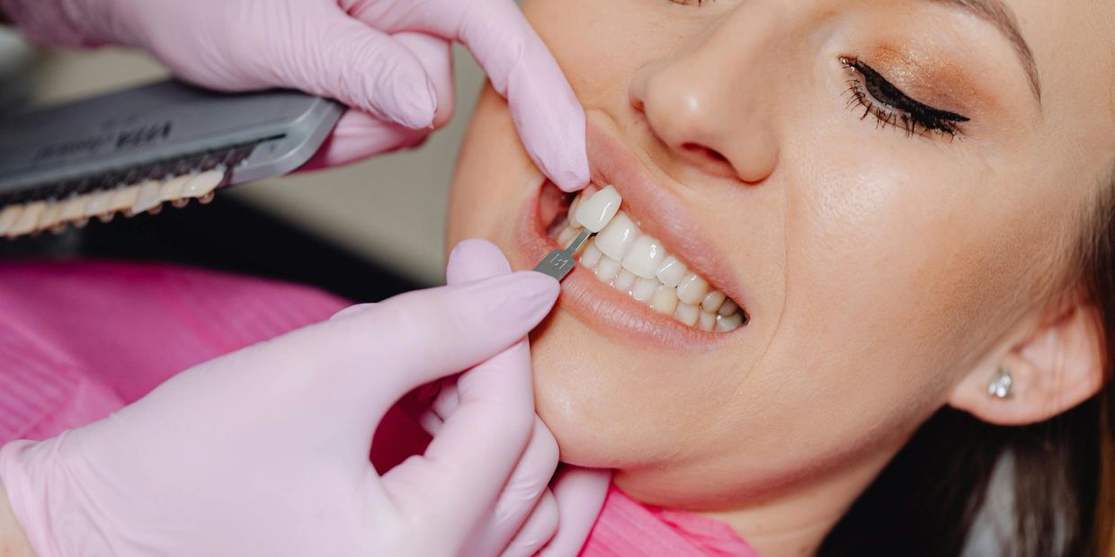 Dentist matching dental veneer shade on a smiling woman.