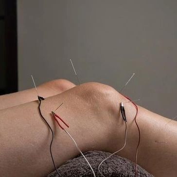 Electro Acupuncture
Acupuncture
Herbal Medicine
Health
Wellness
Pain
Chronic Pain
Inflammation
Herbs