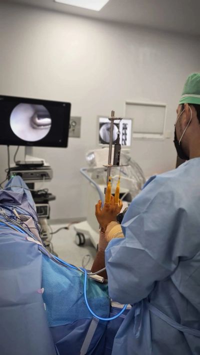 Artroscopía de muñeca