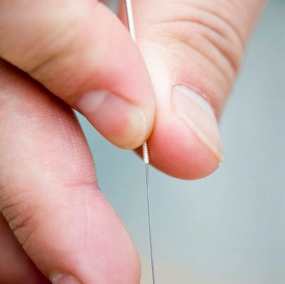 Myotherapy South Morang & Dry needling