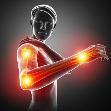 Shoulder pain,Arm numbness, Carpal Tunnel Syndrome, wrist, elbow pain, Golfer’s elbow, Tennis Elbow