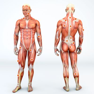 muscle pain, trigger points, back pain, neck pain, radiating pain, massage therapy, Chiropractic 