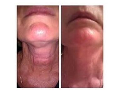 Pure Radiance Natural Skin Care before and after results of Miracle Multiple Peptide and DMAE Cream