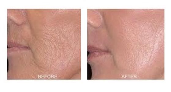 Pure Radiance Natural Skin Care before and after results Miracle Multiple Peptide Serum Vitamin C