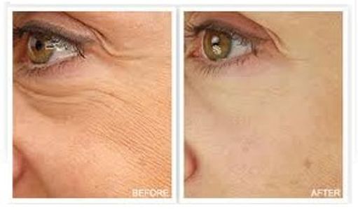 Pure Radiance Natural Skin Care before and after results of Miracle Multiple Peptide Serum