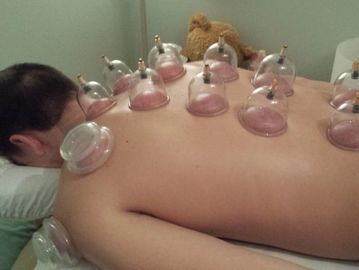 Cupping Class