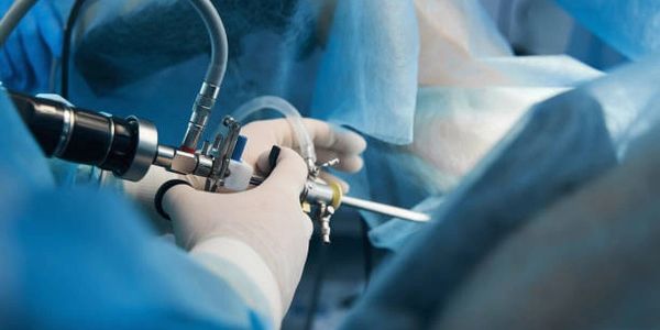 Surgeon performing a laparoscopic surgery.