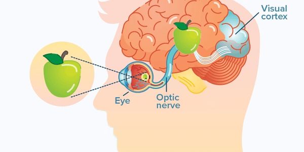 Visual Processing Disorder impacts kids' ability to process what they see. It's a cognitive issue.