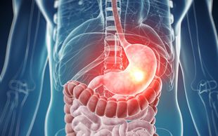 Obezite, Obezite Cerrahisi, Metabolik Cerrahi, Şeker Hastalığı, Tüp Mide,Mide Botoksu