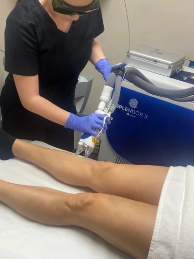 a technician doing a laser hair removal service with a Splendor X Laser hair removal device