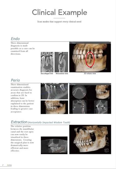 Endodontic cbct