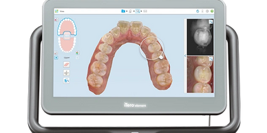 Picture of 5D Oral Scanner by iTero.