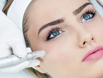 anti wrinkle treatment ageing skin dermal cosmetic treatment dermapen skin needling filler