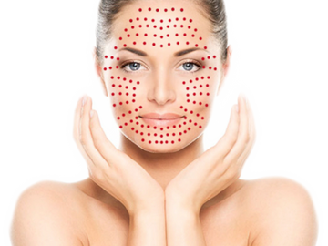 anti wrinkle treatment ageing skin wrinkles cosmetic treatment vampire facials skin needling filler