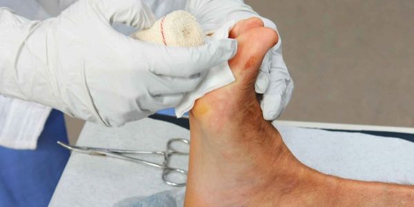 Medical professional treating a foot wound with a bandage in a clinical setting.