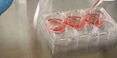 Lab samples