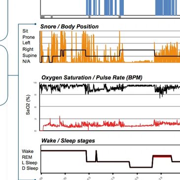 Home Sleep Study Report Sleep Studies at Home