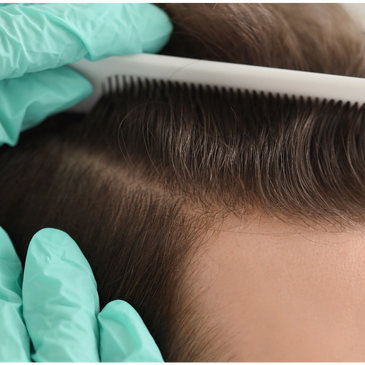 Close-up of scalp examination with gloved hands and white comb.