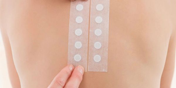 Patch test panel for contact dermatitis helps determine the cause of a skin rash. Dermatology test.