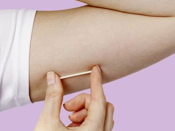 Le coût de la vasectomie est équivalent a 3 ans d'implant cutané hormonal