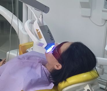 blanchiment dentaire
teeth whitening
cabinet dr ben amor nour el houda