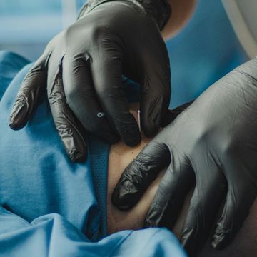 Sanitary Needling