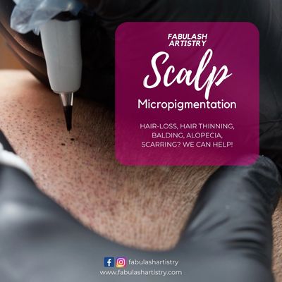 Scalp and hairline micropigmentation services in Jacksonville, FL.