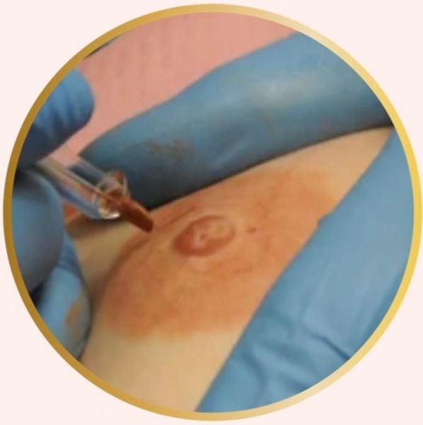 Areola repigmentation procedure at FabULash Artistry in Atlantic Beach, FL.